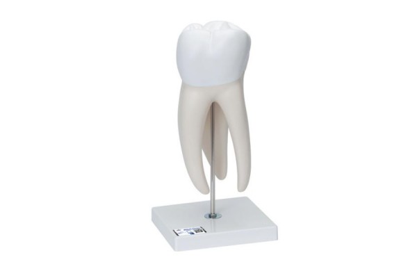 model 6-częściowego zęba trzonowego z ubytakmi, powiększony 15 razy - 1013215 [d15] 3b scientific modele anatomiczne 2